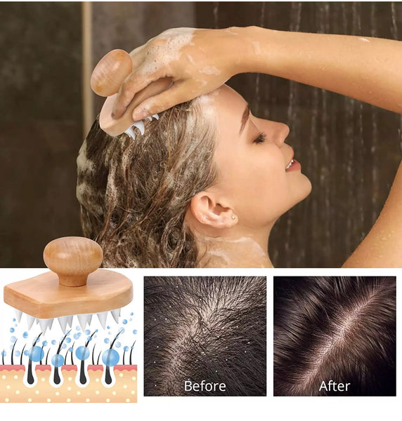 Sweet Lotus Beauty Scalp Massager/Shampoo Brush